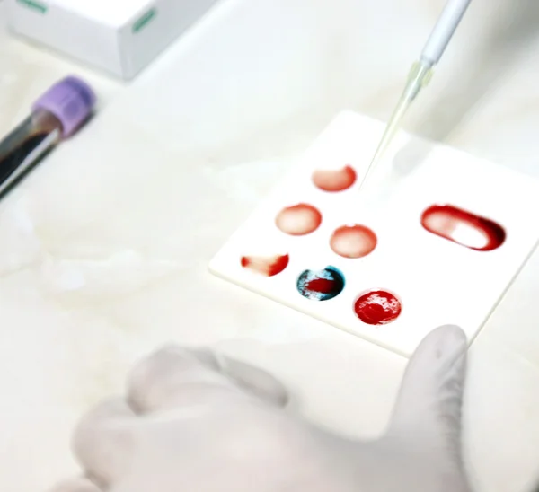 血液検査 — ストック写真
