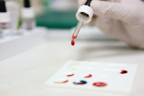 血液测试 — 图库照片