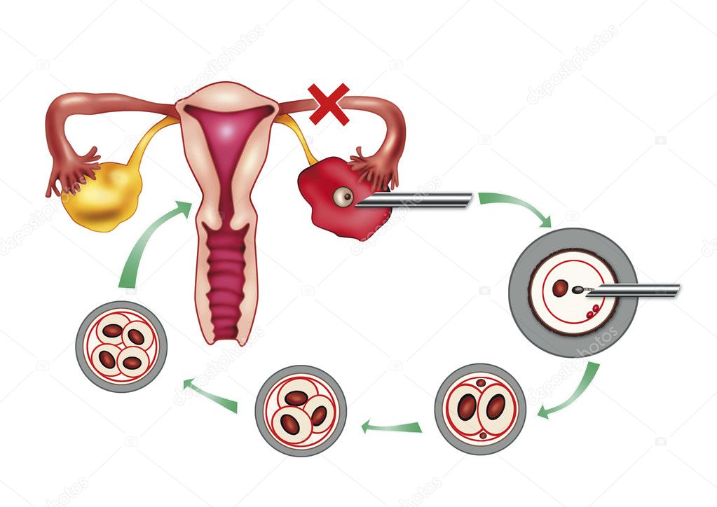 artificial-insemination-stock-photo-izakowski-5387366