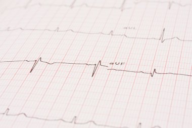 Detail of an electrocardiogram clipart