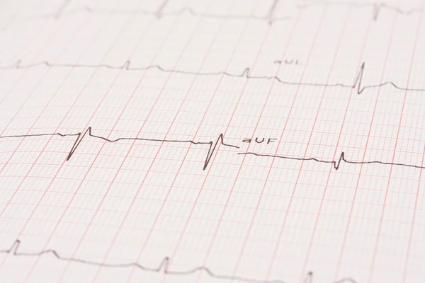 Detalhe de um eletrocardiograma — Fotografia de Stock