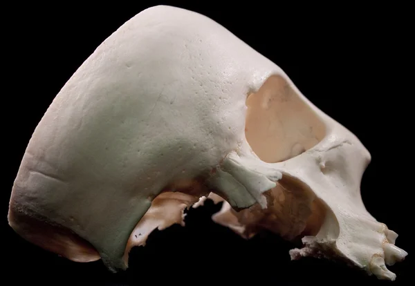 Stock image Human skull - bone head dead teeth spooky scary pirate isolated evil