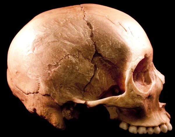 Menschlicher Schädel - Knochenkopf tot Zähne gespenstisch furchterregend Pirat isoliert Böses — Stockfoto