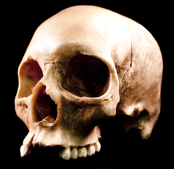 인간의 두개골-뼈 머리 죽은 치아 짜증 무서운 해 적 고립 된 악 — 스톡 사진