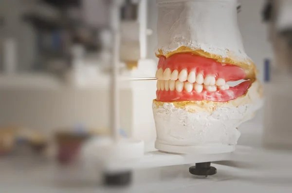 Dental Plate — Stock Photo, Image