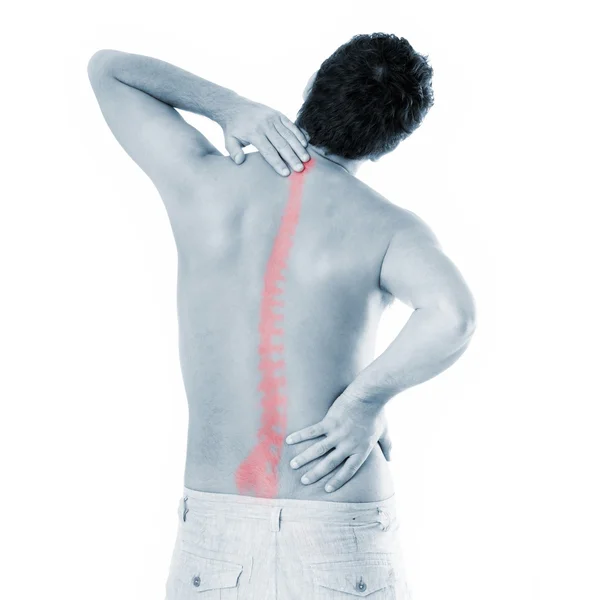 척추 문제 — 스톡 사진