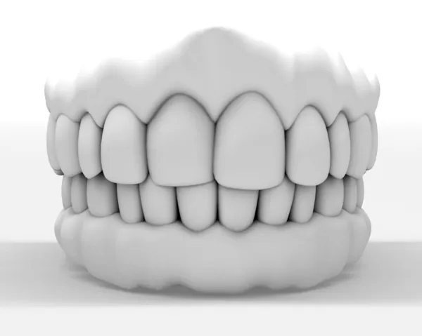 Dentadura 3D — Fotografia de Stock