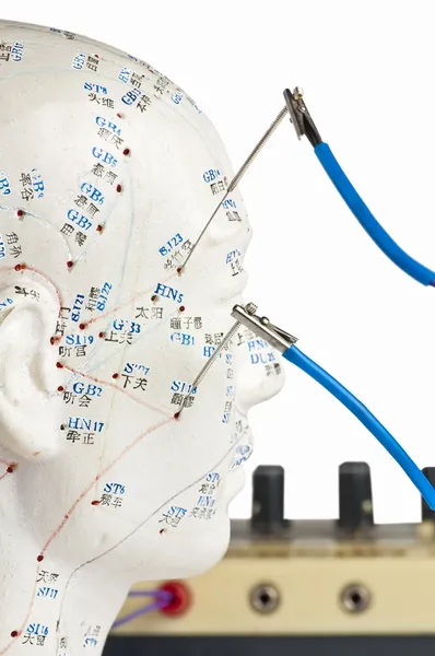 Elektrik-akupunktur — Stok fotoğraf