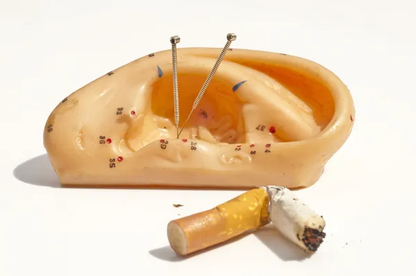 Akupunktur gegen das Rauchen — Stockfoto