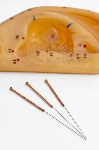 Acupuncture needle ear — Stock Photo, Image