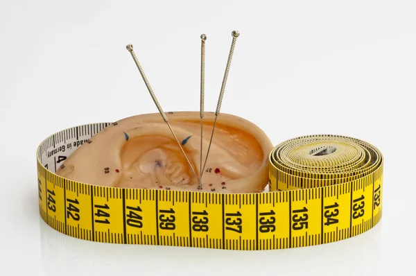 Acupunctuur voor weight loss — Stockfoto