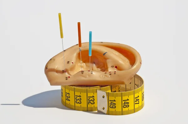 Acupunctuur voor weight loss — Stok fotoğraf
