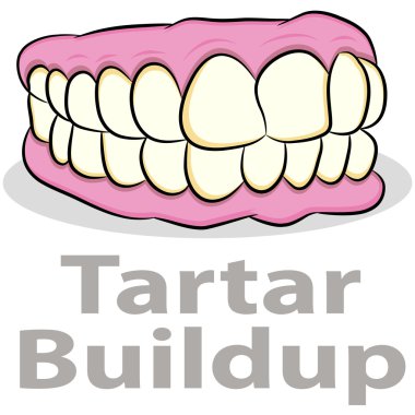 Tartar Buildup on Teeth clipart