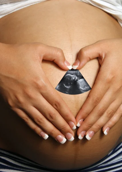 Живіт жінки 8 місяців вагітності, з ультразвуковим зображенням — стокове фото