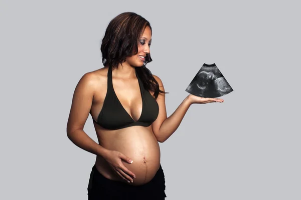 Mulher grávida bonita detém imagem de ultra-som em sua mão — Fotografia de Stock