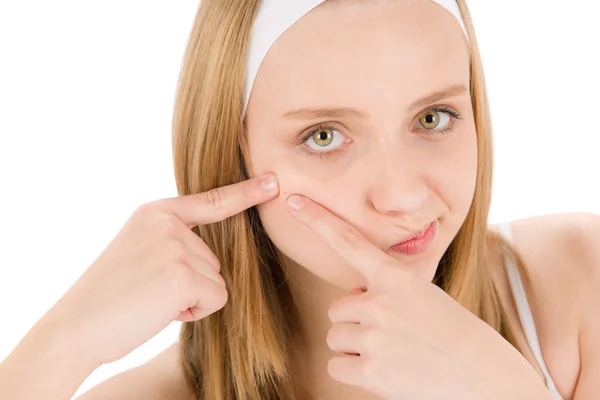 Acne facial cuidado adolescente mulher espremendo espinha — Fotografia de Stock