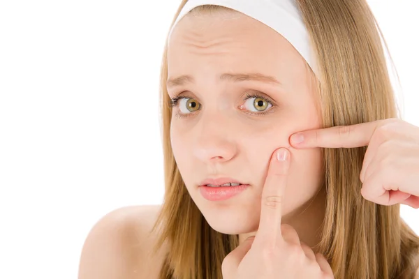Acne facial care teenager woman squeezing pimple — Stock Photo, Image