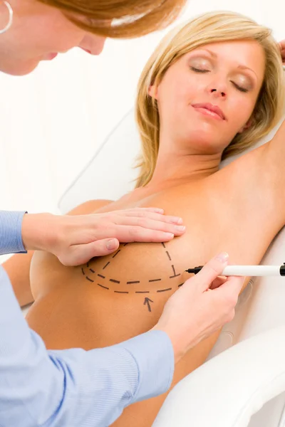 Plastische Chirurgie Arzt ziehen Linie Patientin Brust — Stockfoto