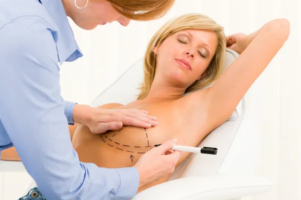 Médico de cirugía plástica dibujar línea paciente mama — Foto de Stock