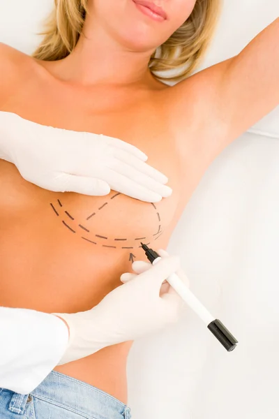 Plastische Chirurgie Arzt ziehen Linie Patientin Brust — Stockfoto