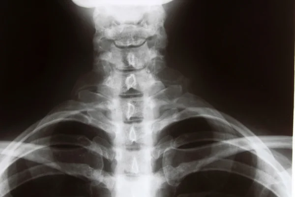 stock image X-ray closeup