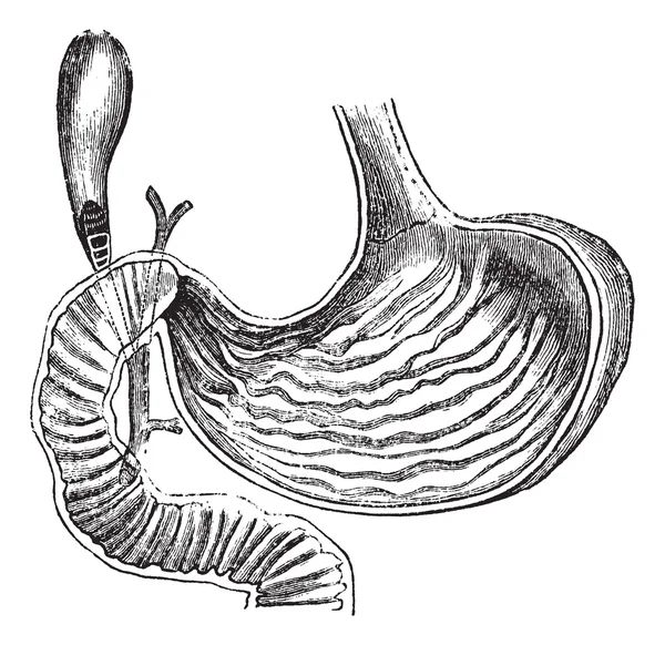 Estómago humano, ilustración grabada vintage — Vector de stock