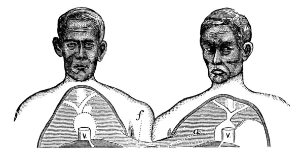 Siamesiska tvillingar. v. hålvenen. f. övre gränsen för den gemensamma axeln, — Stock vektor