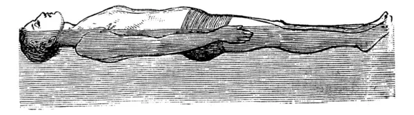 Rückenschwimmer, Vintage gravierte Illustration — Stockvektor