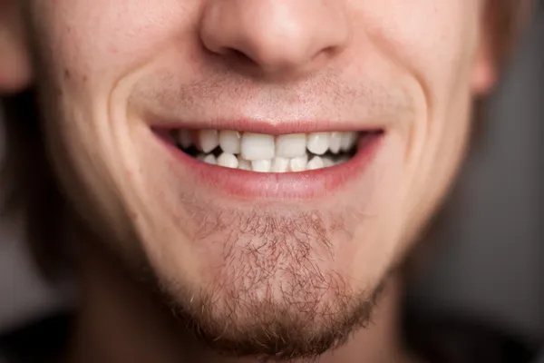 Férfi fogak. közelről. — Stock Fotó