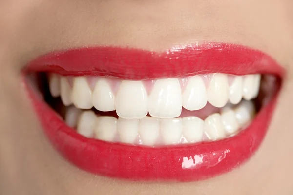 美しい女性の完璧な歯の笑顔 — ストック写真