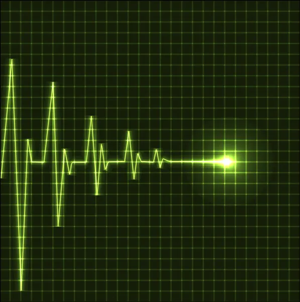 Abstrakt hjärta slår elektrokardiogram — Stock vektor