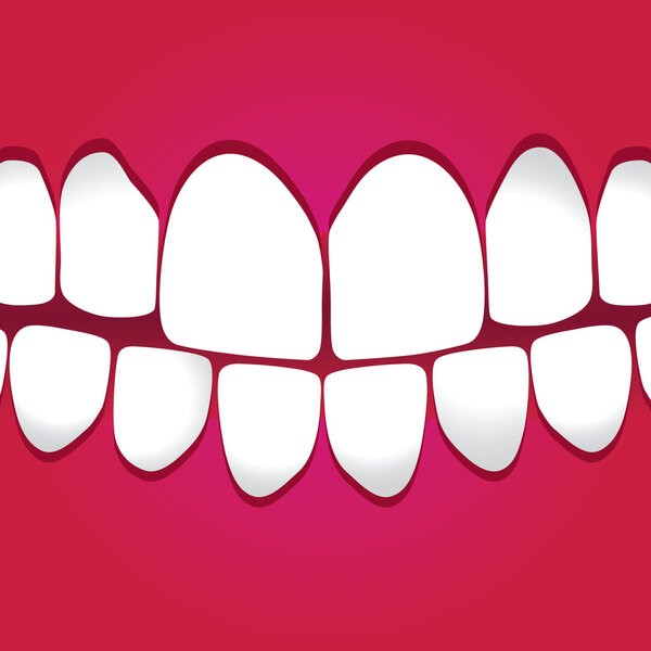 White teeth gums