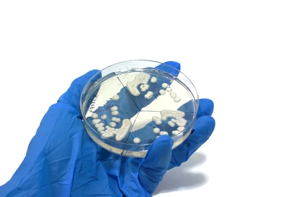 Microorganisms on the plate — Stock Photo, Image