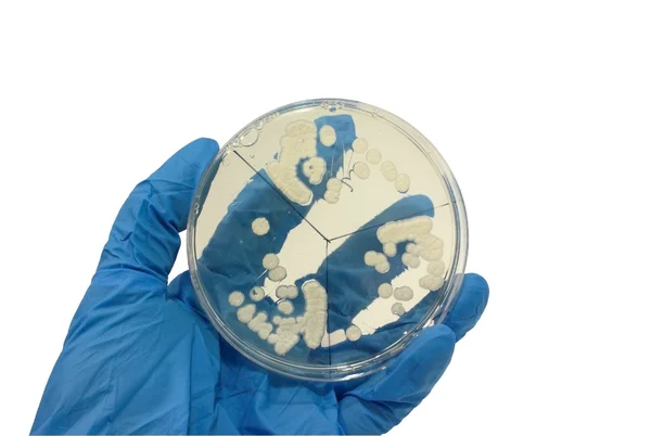 Hand i handske med mibrobiological platta — Stockfoto