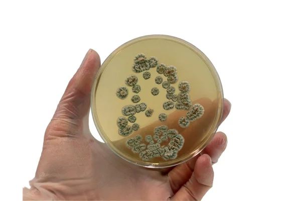 Microorganisms on the plate — Stock Photo, Image