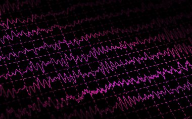 Brain wave EEG isolated on black background clipart