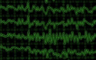 Brain wave on encephalogram EEG clipart