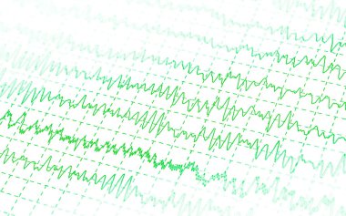 Green graph brain wave EEG isolated on white background clipart