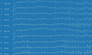 Graph brain wave EEG isolated on white background clipart