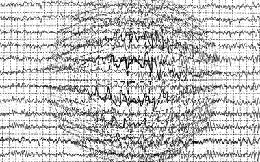 beyin dalga encephalogramme eeg beyaz zemin üzerine izole.