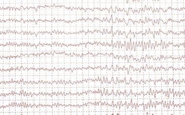 Brain waves electroencephalogramme (EEG) clipart