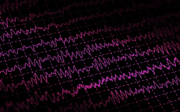 Хвиля мозку EEG ізольована на чорному фоні — стокове фото