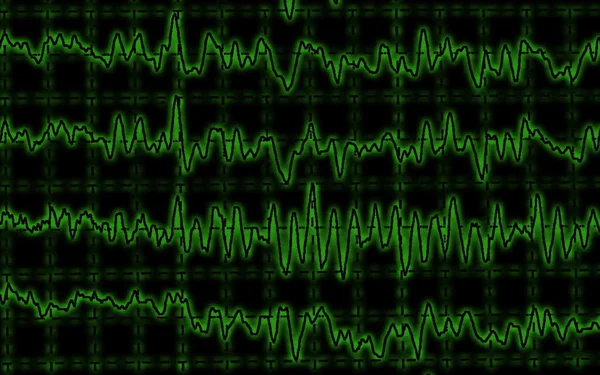 Onda cerebrale sull'encefalogramma EEG — Foto Stock