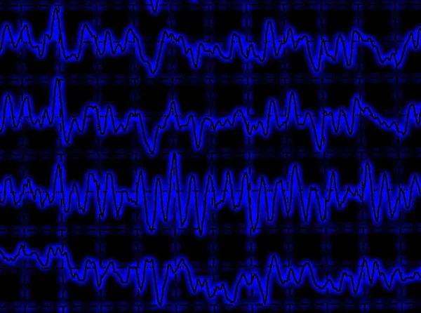 Onda cerebrale sull'encefalogramma EEG — Foto Stock