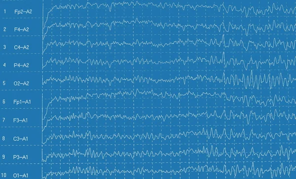 Gráfico EEG de onda cerebral aislado sobre fondo blanco — Foto de Stock