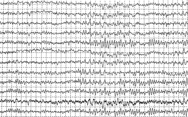 Graphique EEG d'onde cérébrale isolé sur fond blanc — Photo