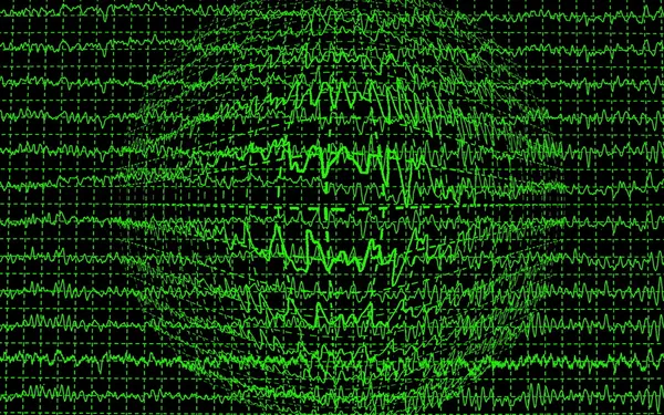 Encefalograma de ondas cerebrales EEG aislado sobre fondo negro — Foto de Stock