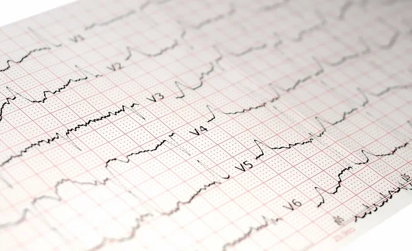 Elektrokardiyogram EKG, ekg — Stok fotoğraf