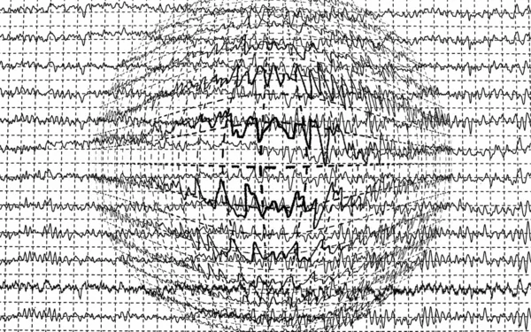 Хвильова енцефалограма мозку EEG ізольована на білому тлі — стокове фото