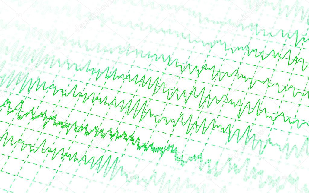 Green graph brain wave EEG isolated on white background